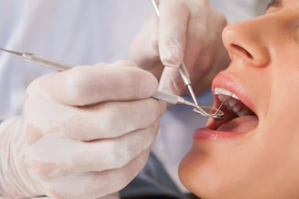 Tratamento odontológico grátis: tudo o que você precisa saber!
